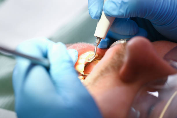 Best Holiday Emergency Dentist in Indianola, WA