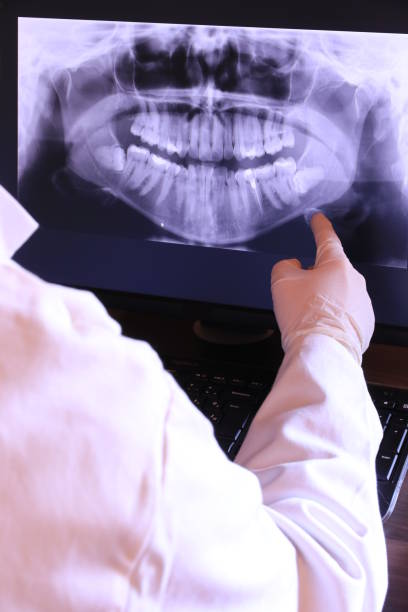 Best Broken or Cracked Tooth Emergency Dentist in Indianola, WA